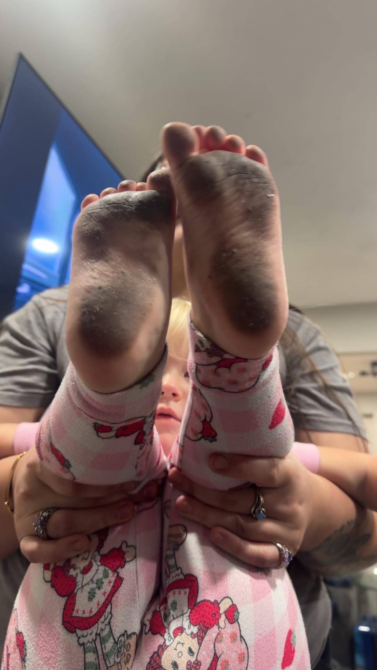 Two yr olds feet after walking on the floor 