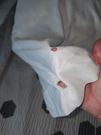 Cigarette burns in sheets, bedding, and pillow cases