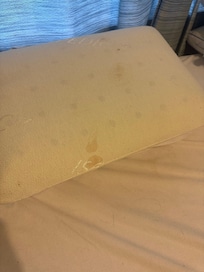 Blood stain on pillow
