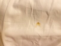 Smears on sheet