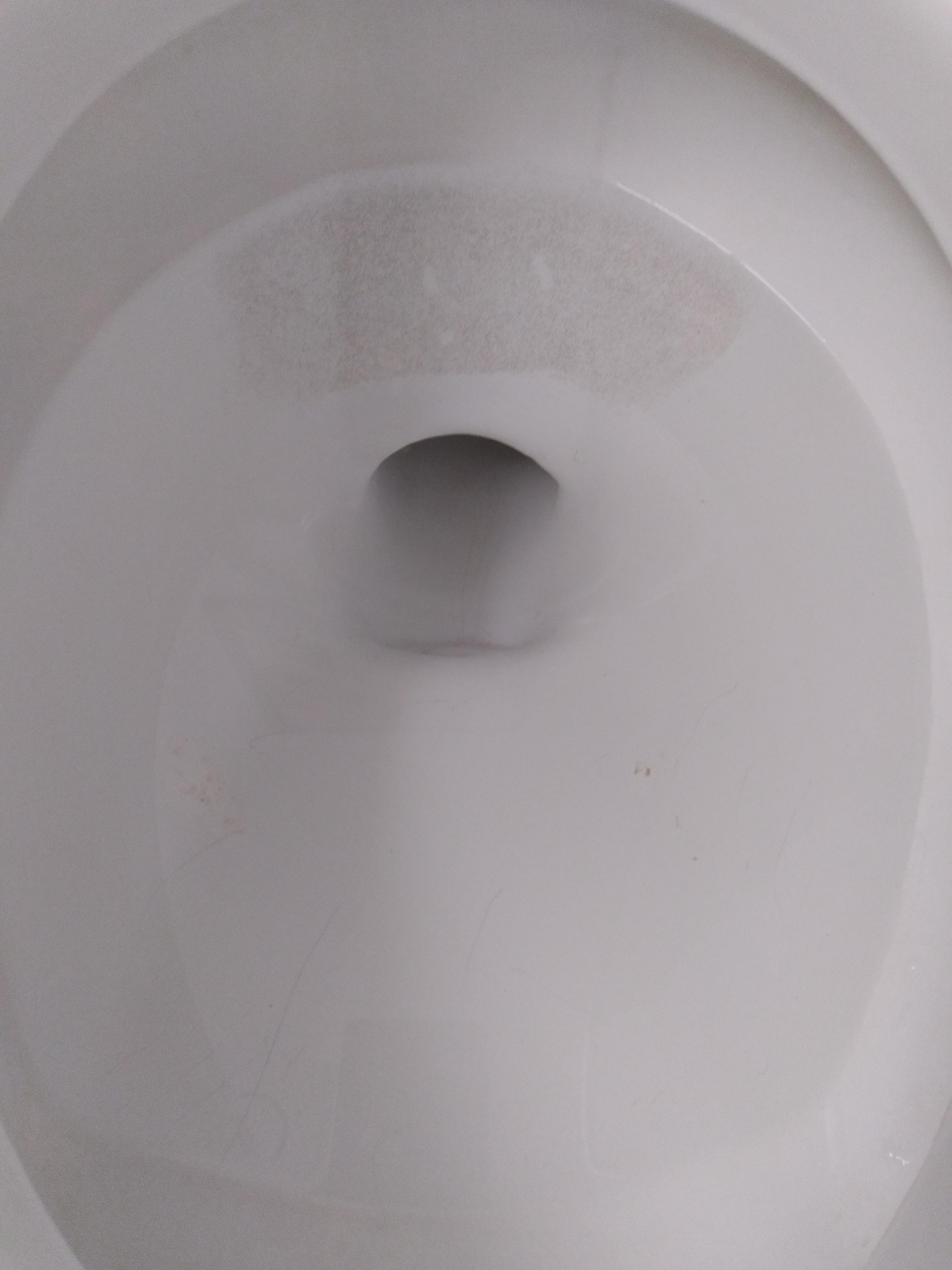 Black mold in the toilet which was obviously not cleaned