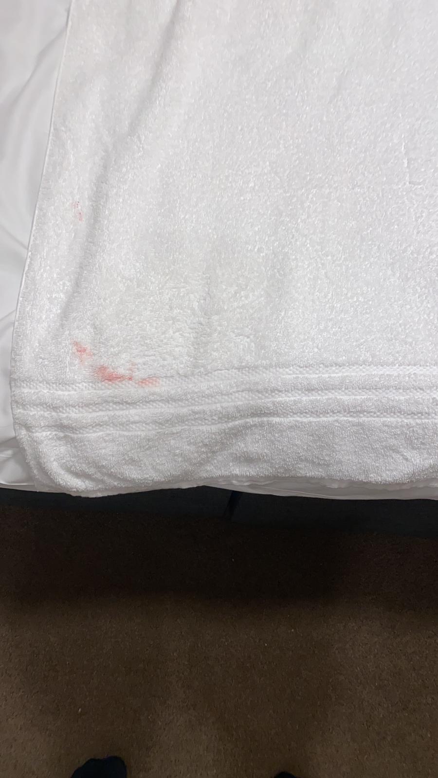 blood on towels