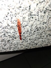 Blood on counter facing