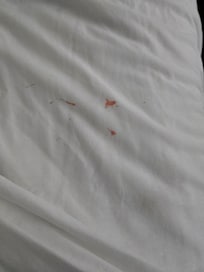 Blood stains