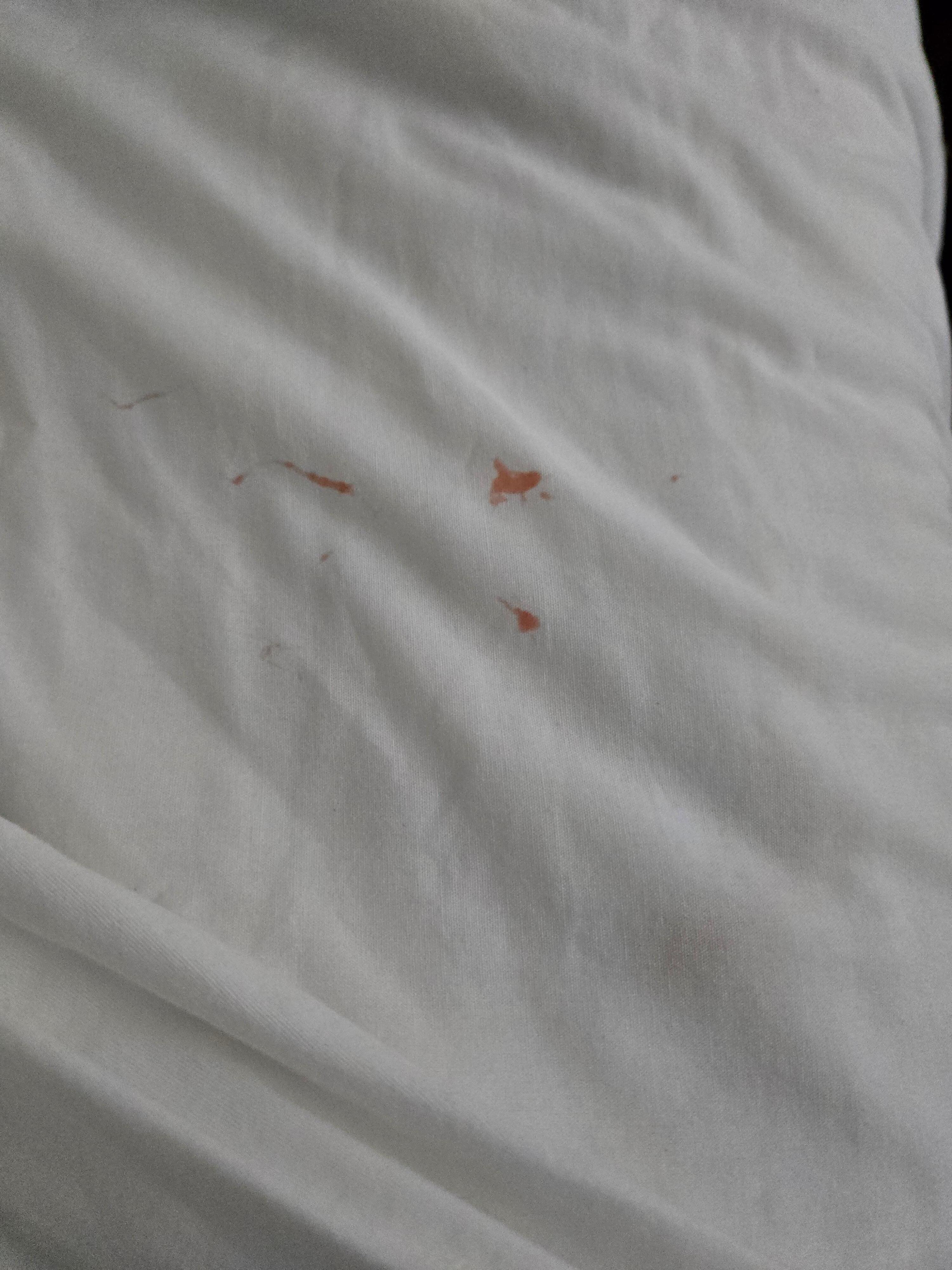 Blood stains