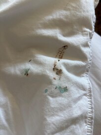 Stains on bed sheets