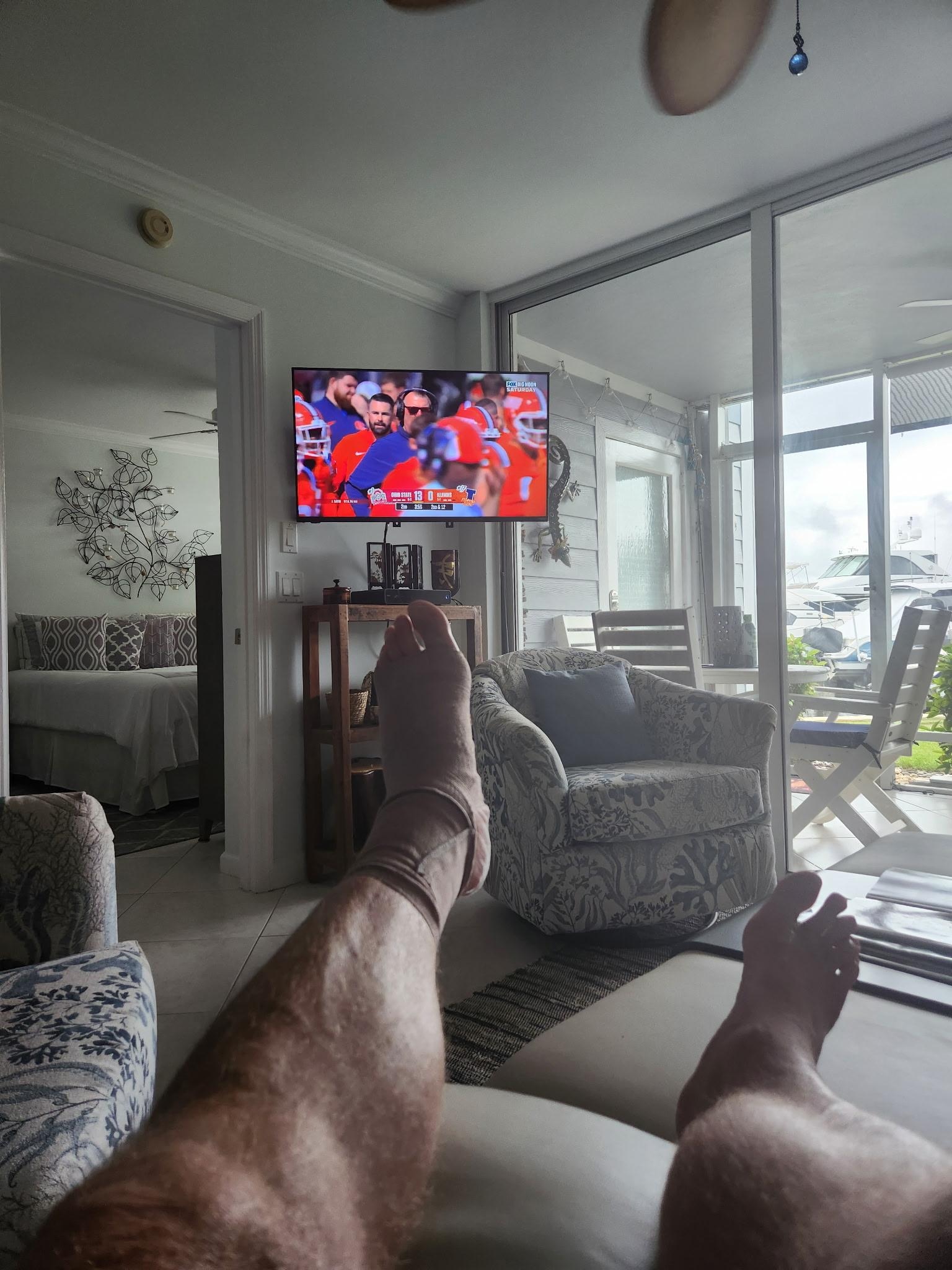 Guest injured foot weeks after returning to US. 