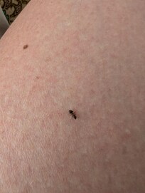 photo attached of an ant on my leg while in bed