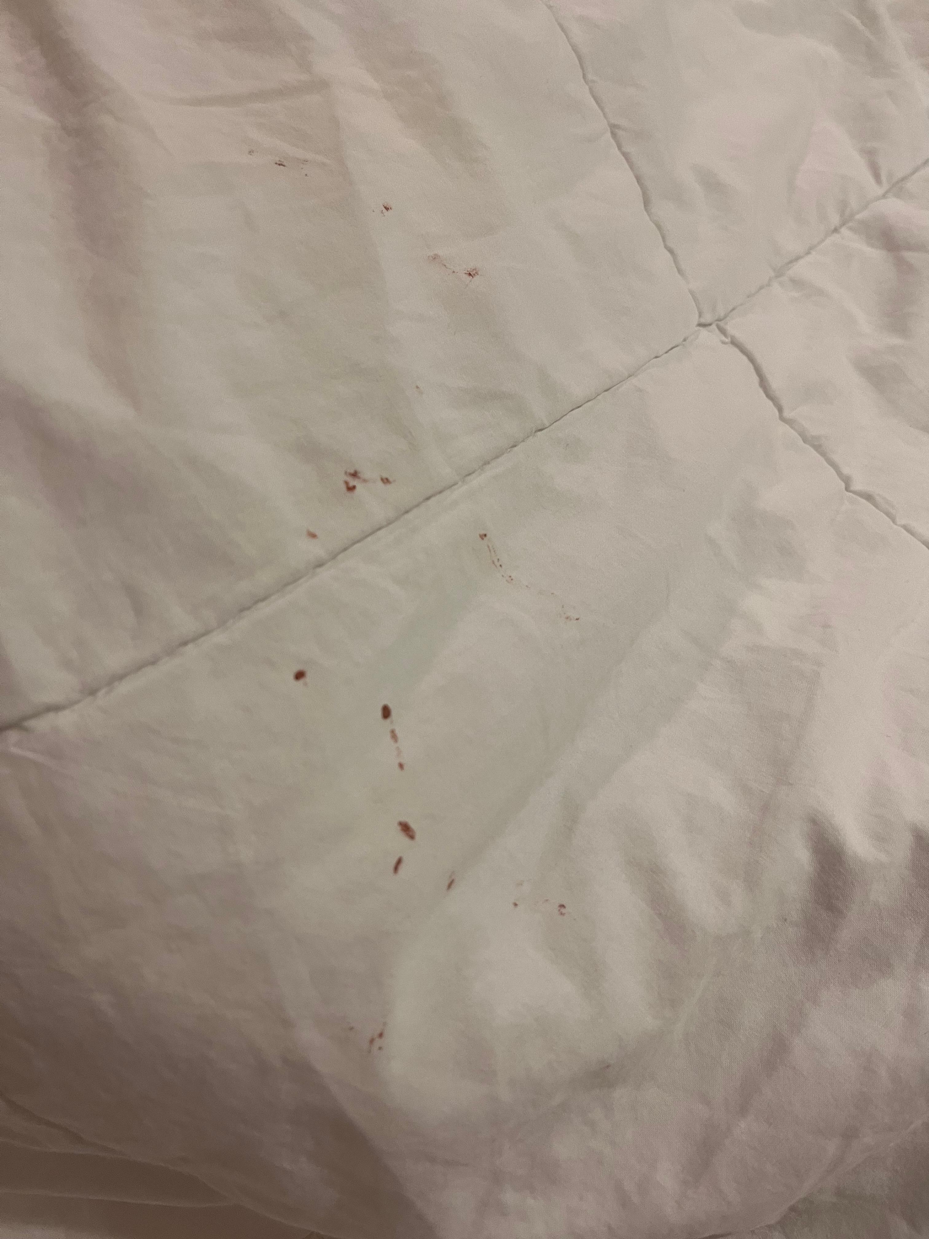 Blood stains 