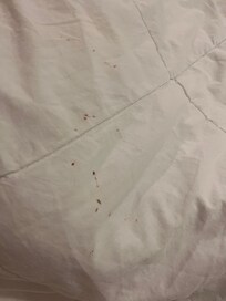 Blood stains