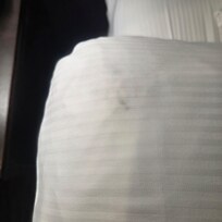 Moldy pillowcase