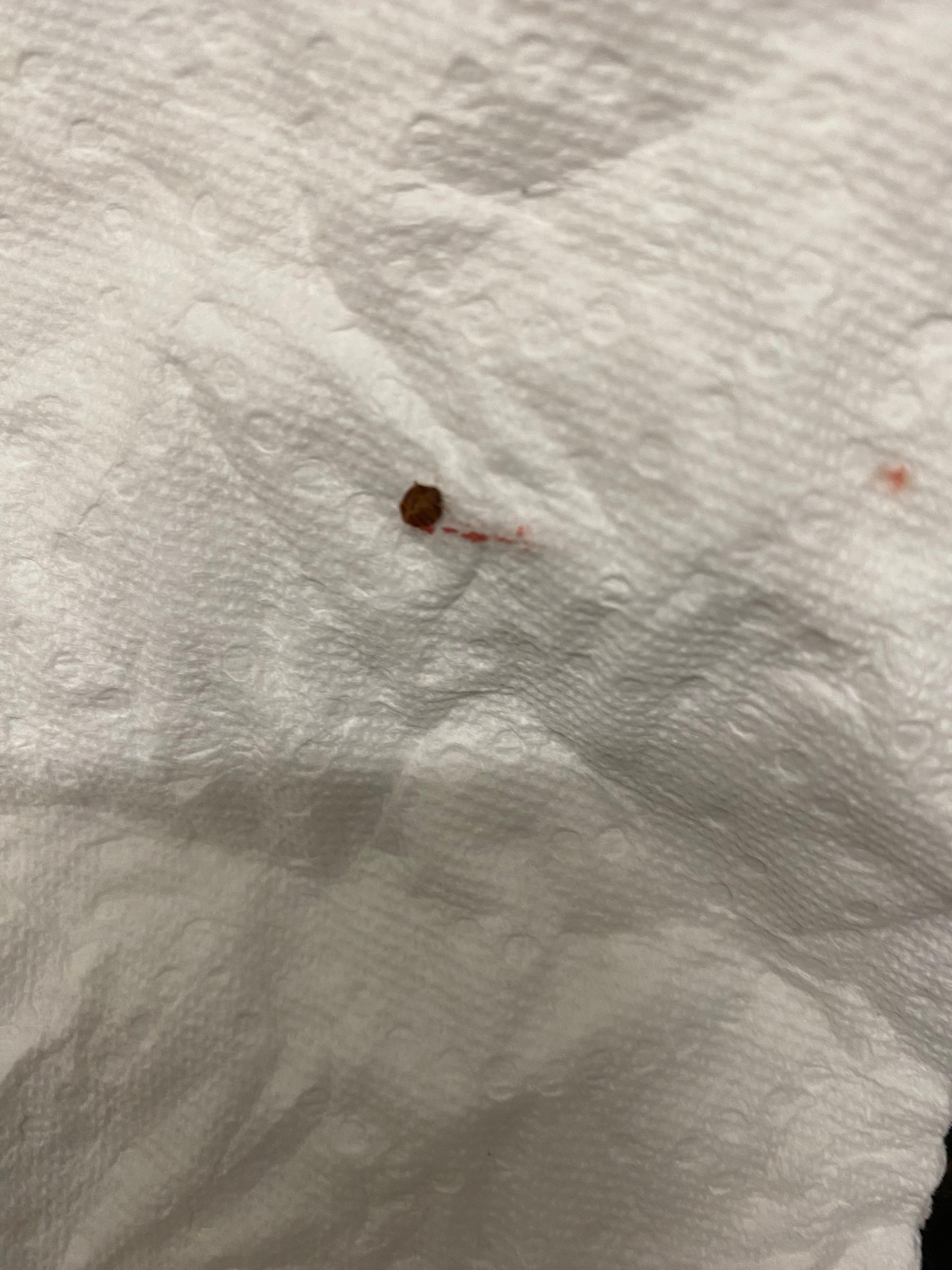 Piqûre punaise, déposée à l’accueil de l’hôtel.
Ne pas y aller !