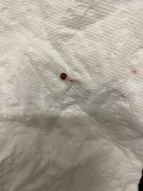 Piqûre punaise, déposée à l’accueil de l’hôtel.
Ne pas y aller !