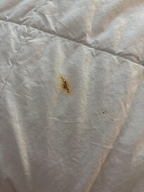 Feces on duvet
