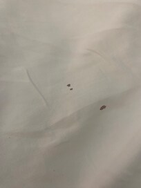 Blood stain on sheets