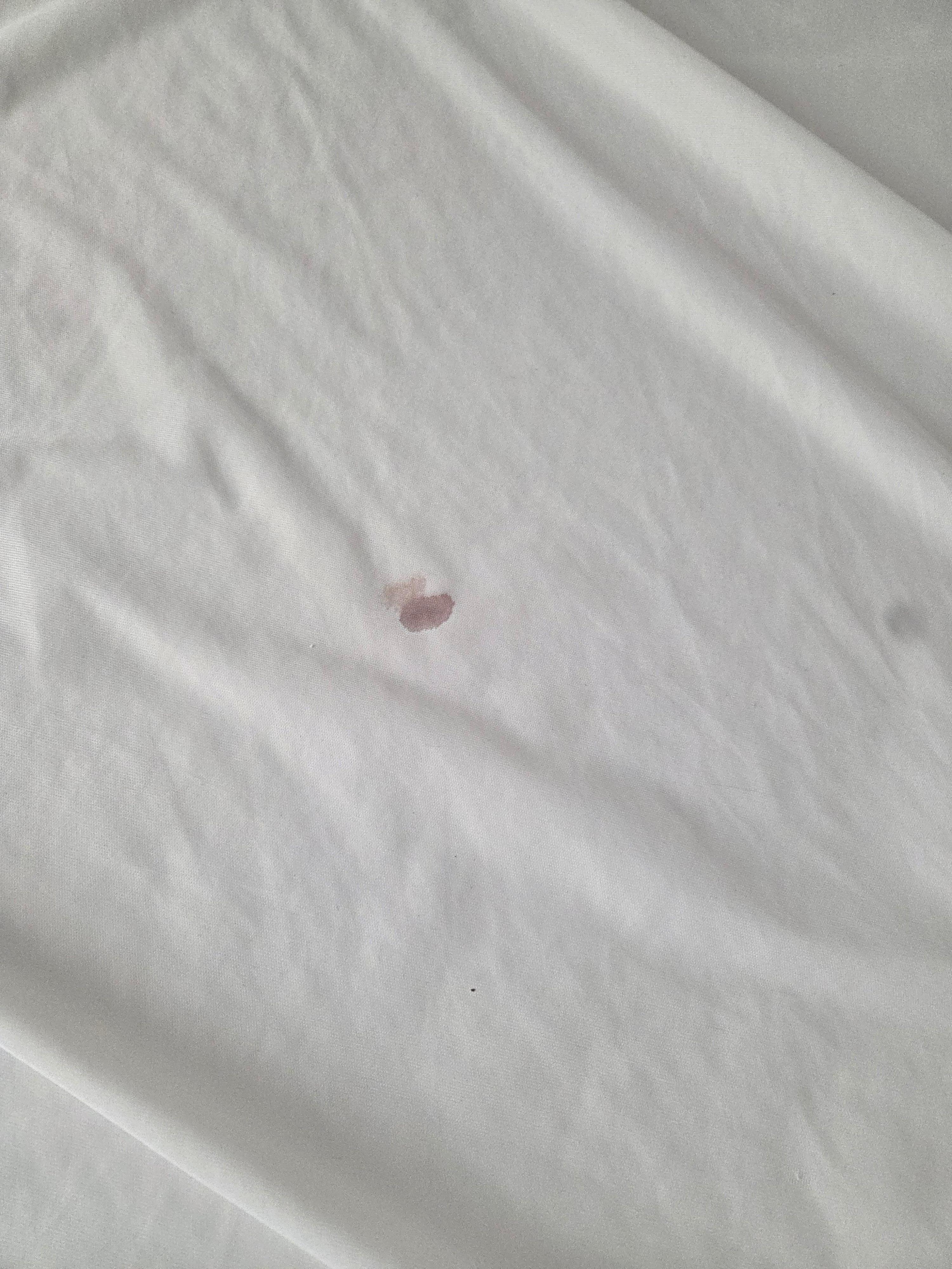 How, why? Who just ignores this... its not the sheet, it's the mattress cover. I just can't 🤢🤮