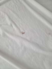 How, why? Who just ignores this... its not the sheet, it's the mattress cover. I just can't 🤢🤮