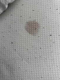 Stain on the mattress