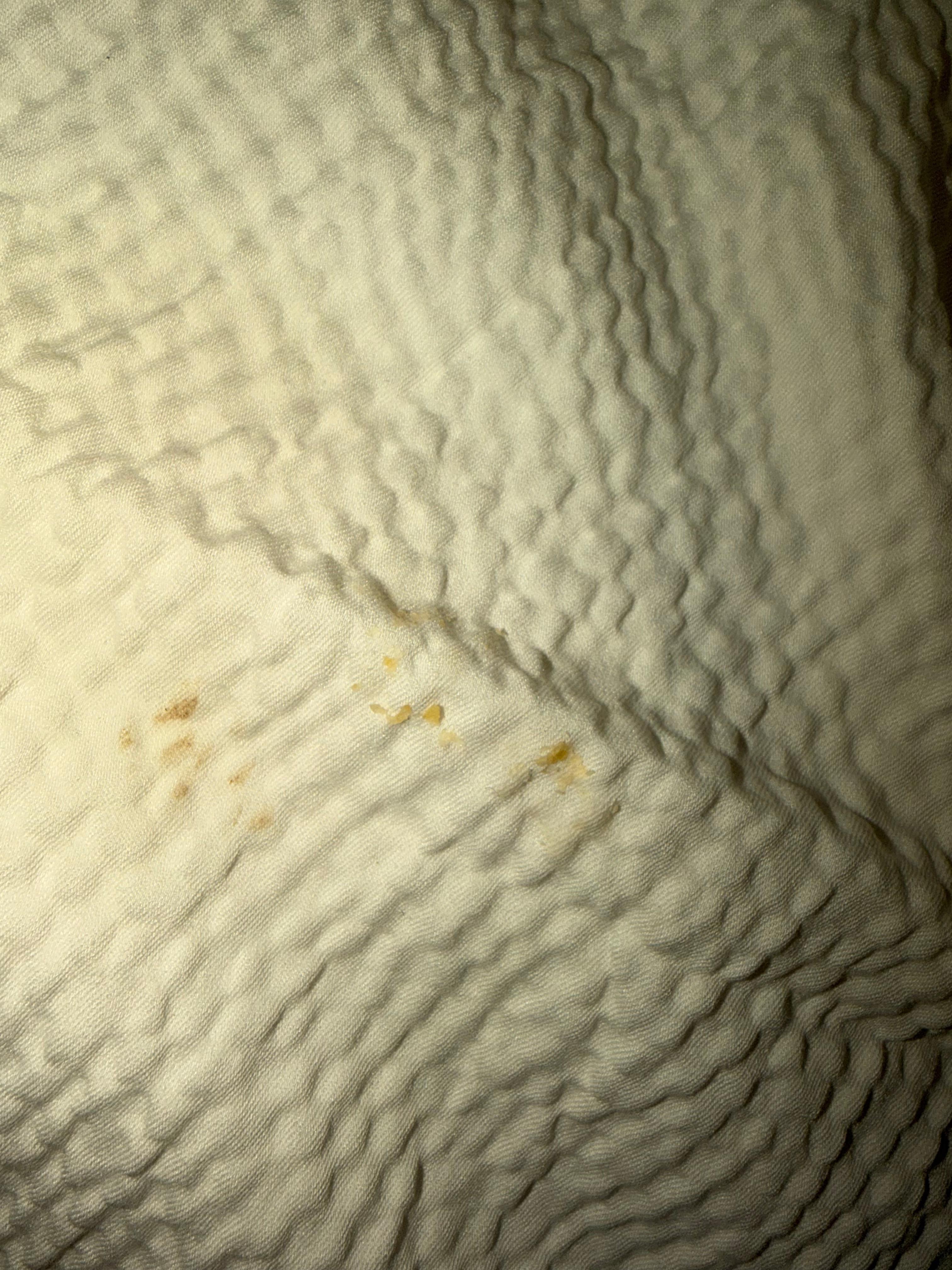 Dirty bedding, food in bed 