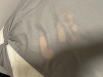 Dirty pillows and linen.
