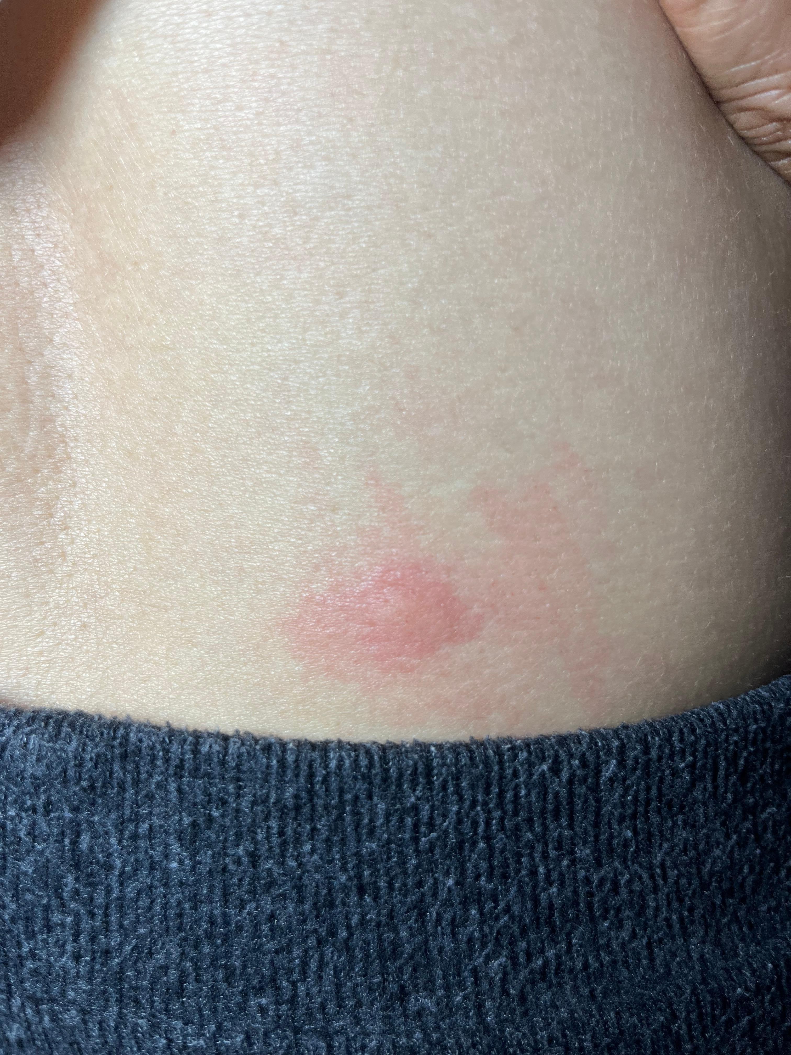 Plaga en la habitación. Ademas de que ningun dia la asearon. Olia a orines de perro. Totalmente nefasto. Desde la entrada alfombra muy sucia. Se nota la falta de limpieza por todo el hotel !!