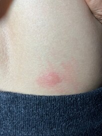 Plaga en la habitación. Ademas de que ningun dia la asearon. Olia a orines de perro. Totalmente nefasto. Desde la entrada alfombra muy sucia. Se nota la falta de limpieza por todo el hotel !!