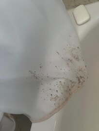 Mold on shower curtain