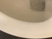 Would you want to sit on this toilet seat.  Is this what you would expect in a hotel.