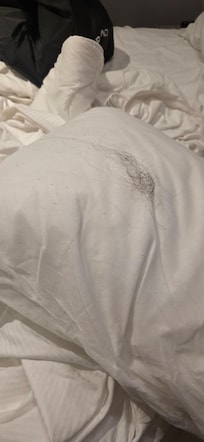Took out the pillow case and found a bunch of hair
