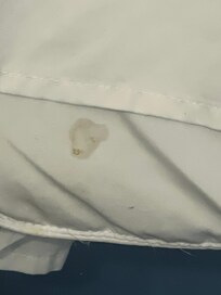 Stains on the beds