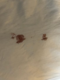 Bloody bed sheets