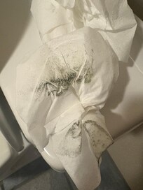 Mold on Toilet Paper!