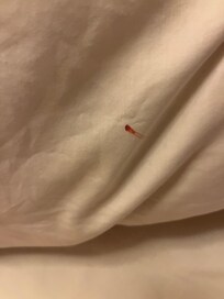 Aplastamos a los insectos y dejaban rastros de sangre