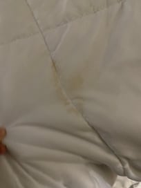 Unknown yellowish stain