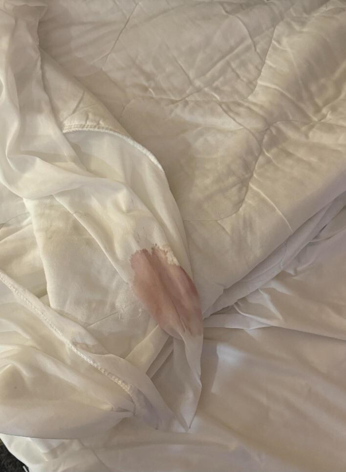 Gross blood like stain? 