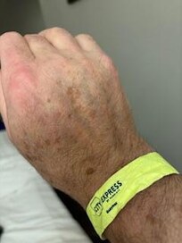 Annoying & Uncomfortable Wrist Bands