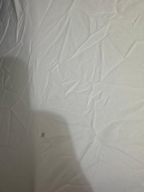 One of the holes in the bedsheets