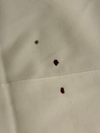 Al aplastar la chinche le salió sangre, ya estaba dormida