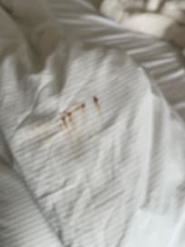 Brown stains on white linen.