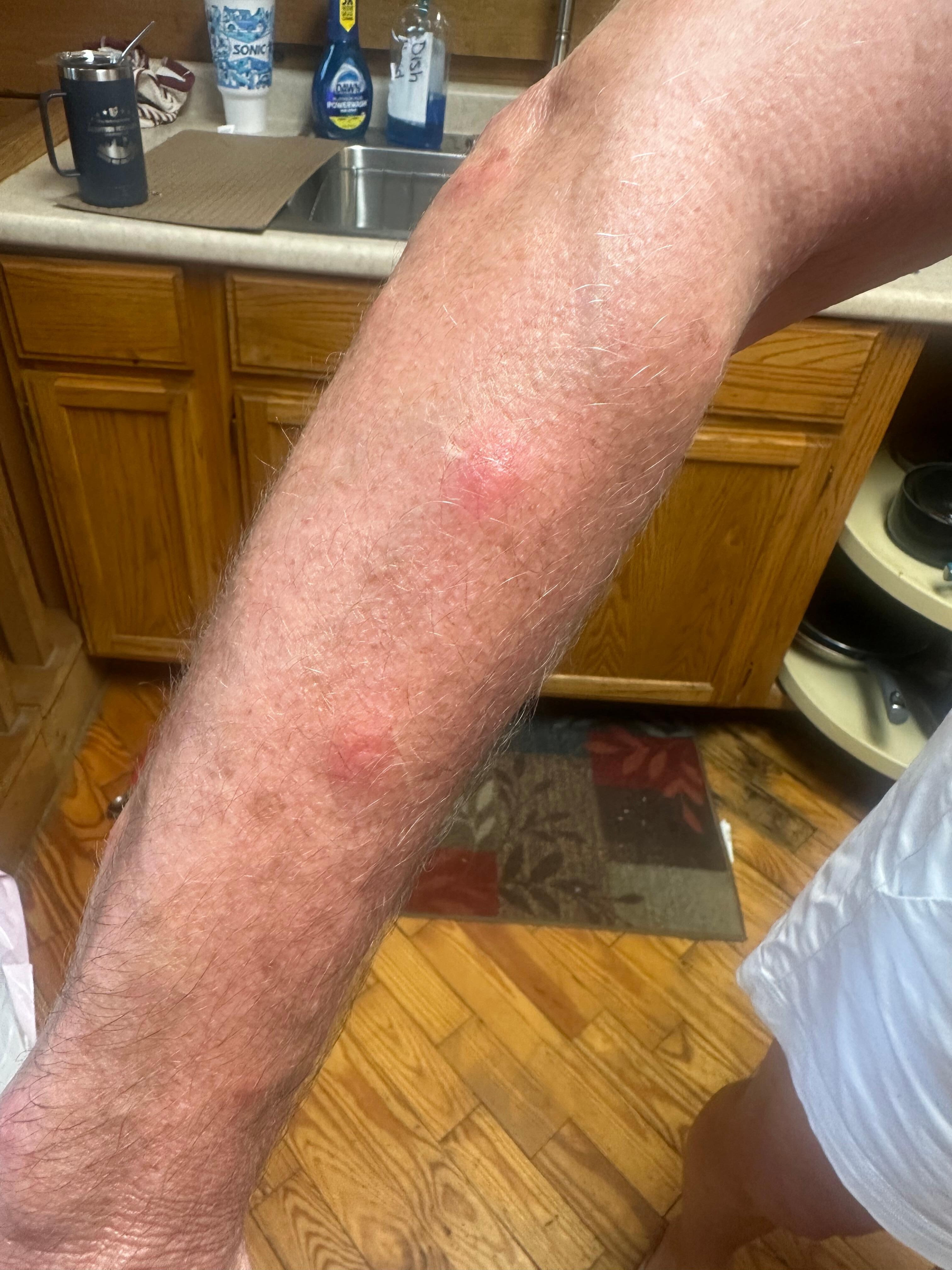 More bite marks