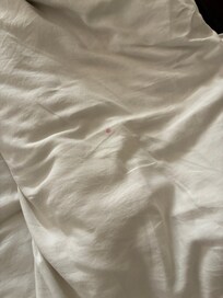 Stains on sheets