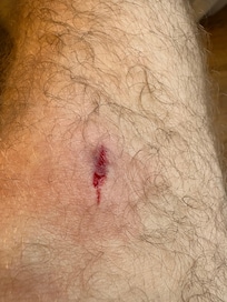 Leg blessure in the shelf