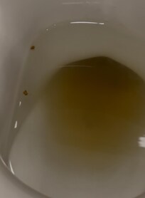 My toilet when I arrived