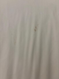 Blood stains on the sheet