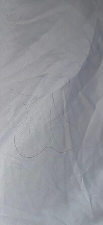 Pet hairs on the bedsheet.