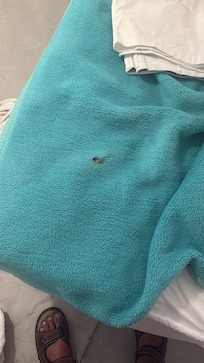 Not sure what this is, looks like a cigarette burn.