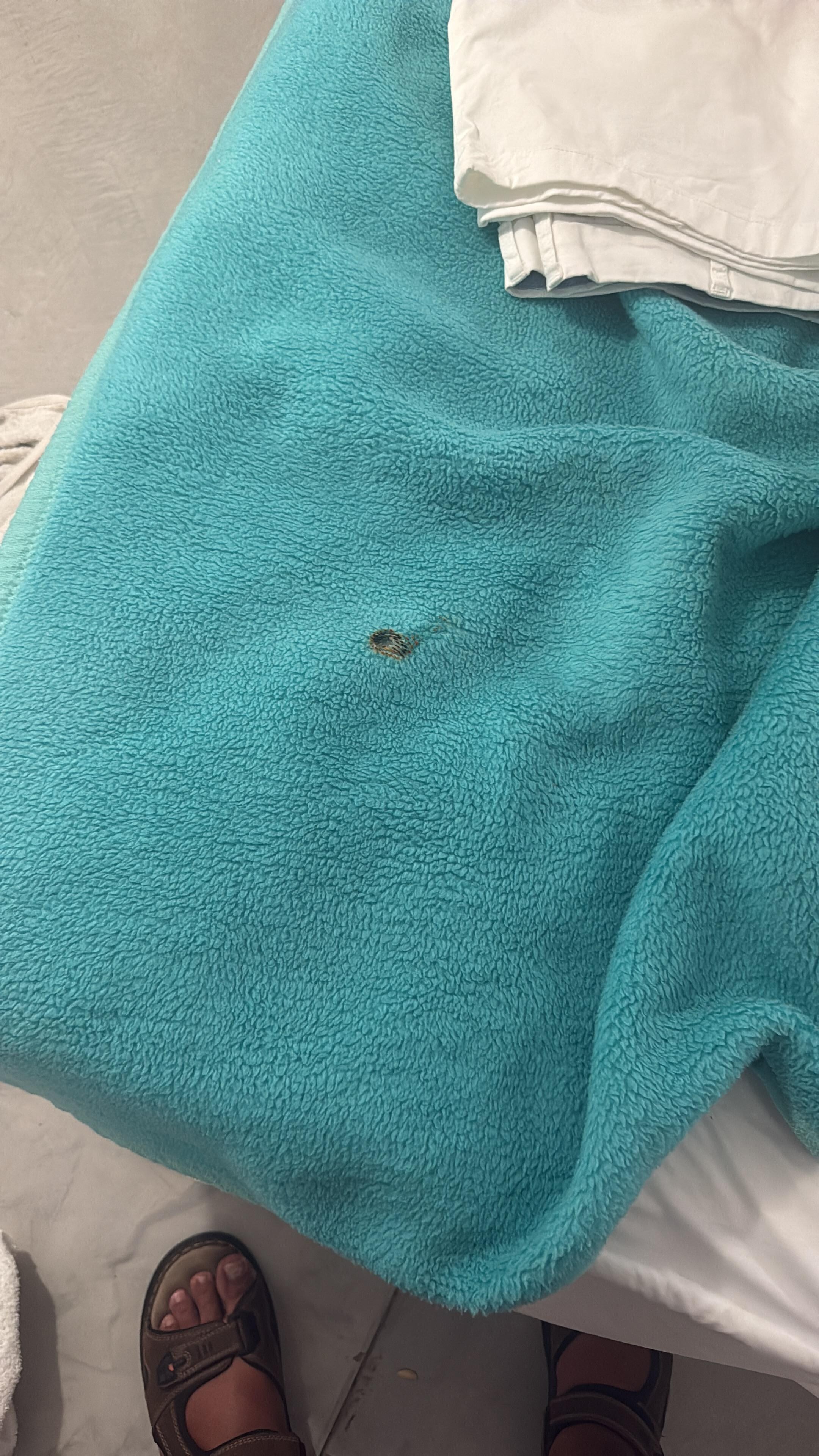 Not sure what this is, looks like a cigarette burn.