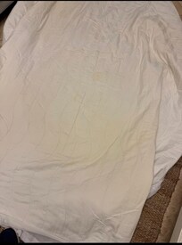 Urine stain on mattress cover.