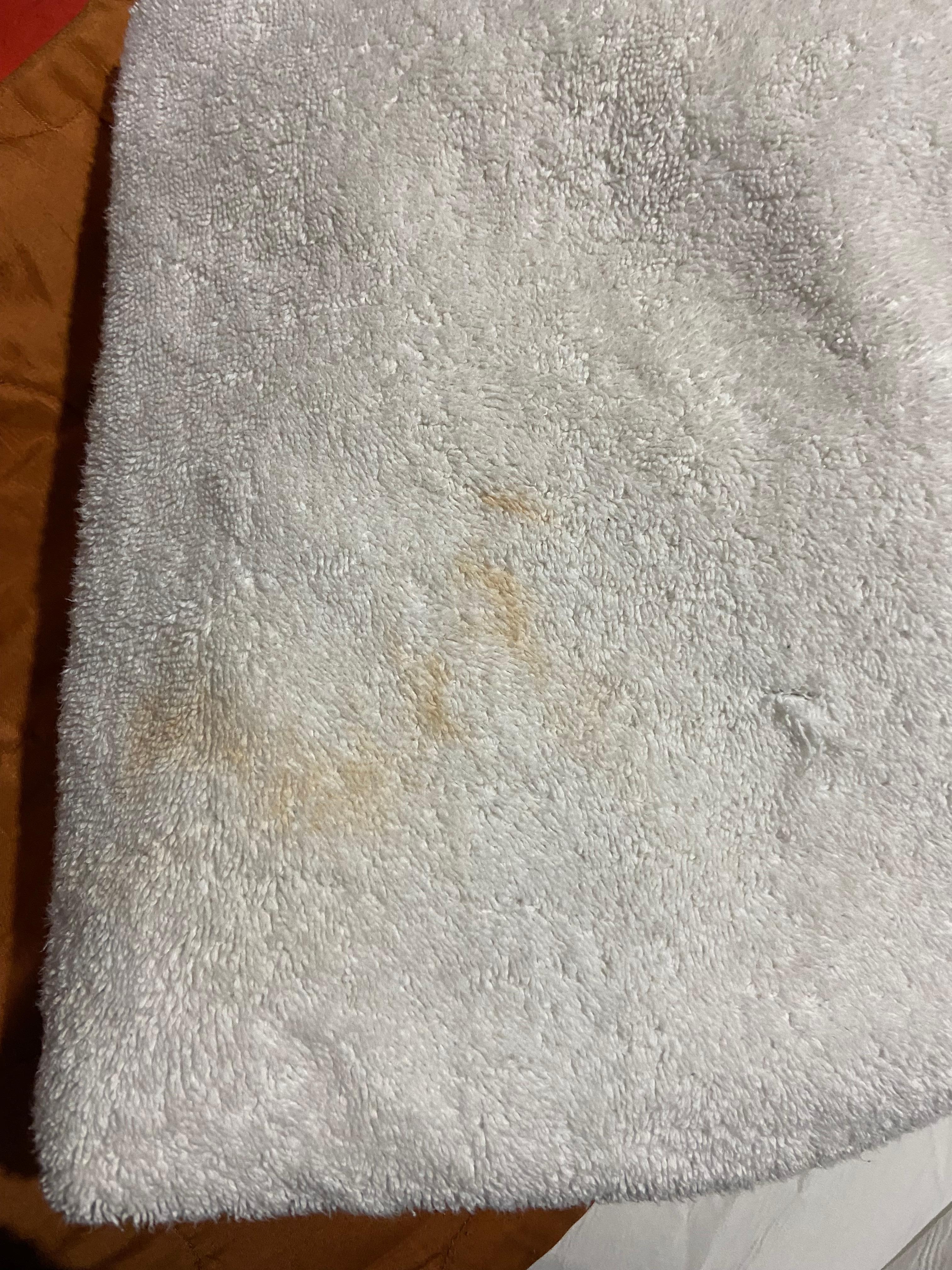 Stains on towels  , old- looking towels 