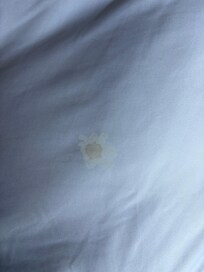 Stain on bed